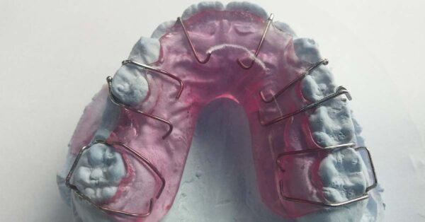 Online corso ECM "Incontro di aggiornamento della Scuola Ortodontica Pavese 2021"
