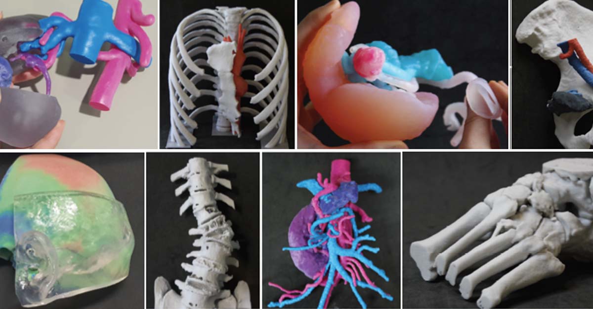 17 novembre - Stampa 3D per il settore cardiovascolare